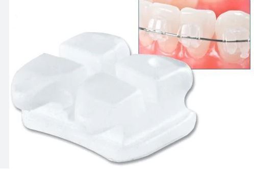 Bộ mắc cài sứ Gemini Clear 3M ESPE